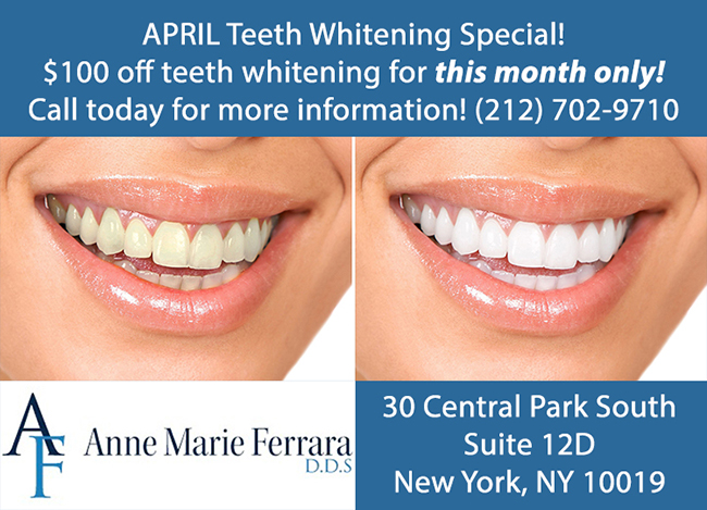 Teeth Whitening Special